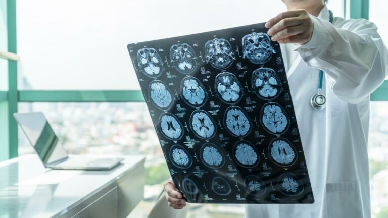 Handicap neurologique : Un troisième appel à projet lancé pour améliorer le parcours de soins des patients