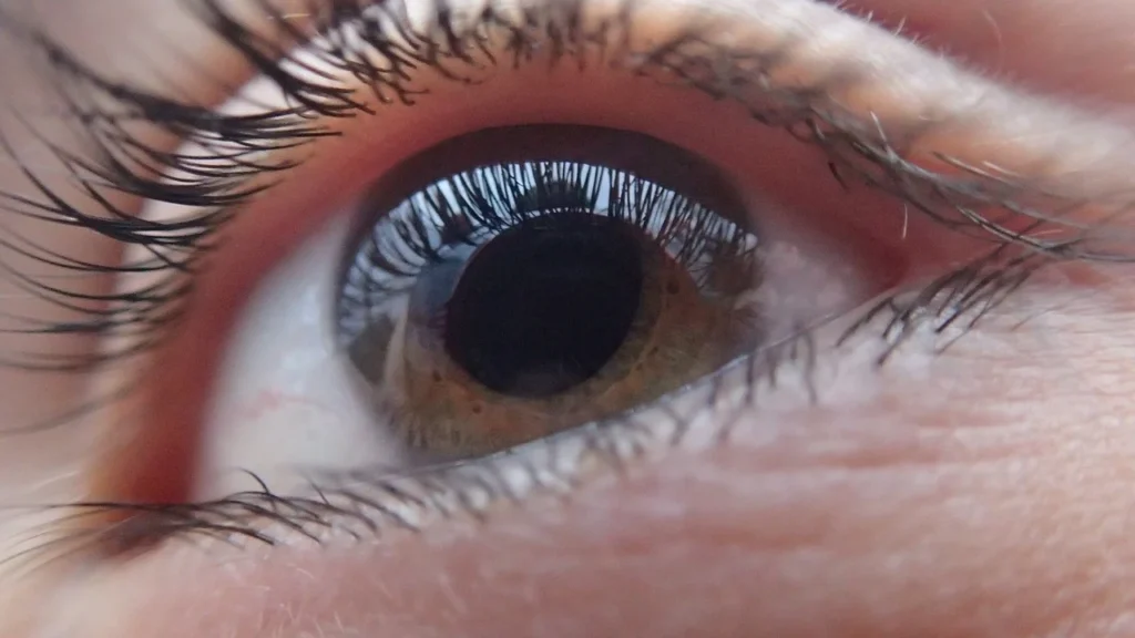 Glaucome : Éclairage sur cette maladie à l'origine de troubles de la vision